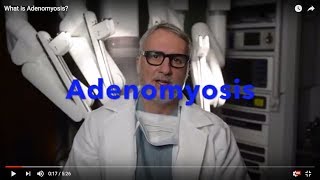 What is Adenomyosis [upl. by Onirefes]