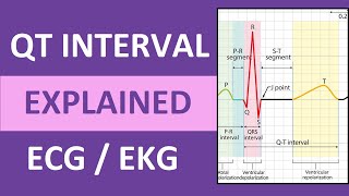 QT Interval Explained ECG  EKG Interpretation Nursing NCLEX [upl. by Nahor]