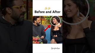 Nimrat kaur Before amp after lip filler💋 shorts ytshortsyoutubeshorts abhishekbachchan nimratkaur [upl. by Papp]