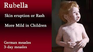 Rubella German Measles symptoms and treatment what is difference between Rubella and measles [upl. by Melodie]