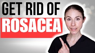 How To Get Rid Of Rosacea  Dermatologist Tips [upl. by Caldera]