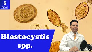 Conoce a Blastocystis spp Morfología y CLAVES para su identificación Laboratorio de parasitología [upl. by Egoreg]