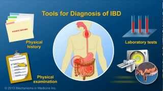 Diagnosing IBD [upl. by Wallie]