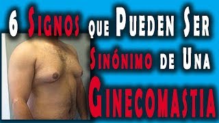 6 Signos que Pueden Ser Sinónimo de UNA Ginecomastia 👤 [upl. by Ymac817]