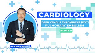 Cardiology  Lec 13  ll Deep Venous Thrombosis  DVT  amp Pulmonary Embolism ll [upl. by Onil]