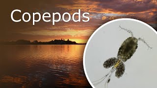 Copepods Cyclops Under a Microscope Description Habitat and Anatomy [upl. by Hendrick]