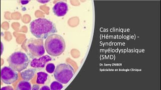 Cas clinique  Syndromes myélodysplasiques SMD [upl. by Taddeusz23]