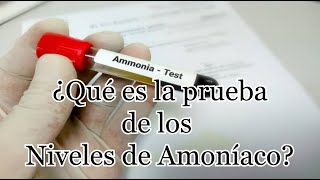 ¿Qué es una prueba de niveles de amoníaco [upl. by Eldred]