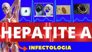 HEPATITE A  CARACTERÍSTICAS SINTOMAS DIAGNÓSTICO E TRATAMENTO  INFECTOLOGIA [upl. by Hrutkay585]