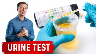 Urine Test Simplified [upl. by Flavius]