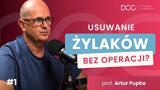 Usuwanie żylaków BEZ OPERACJI Wchodzisz i wychodzisz  Prof Pupka  Intymnie o Zdrowiu 1 [upl. by Ecarret]