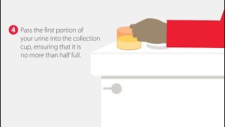 How to Collect a Urine Sample  StepbyStep Guide [upl. by Ejroj]