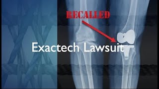 Can You Sue For Bad Knee Replacement  Exactech Knee Lawsuit [upl. by Nyladgam675]