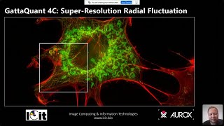 ACoM2021 Dr Mika Ruonala Pushing the resolution limits of laser free confocal microscopy [upl. by Ennirac]