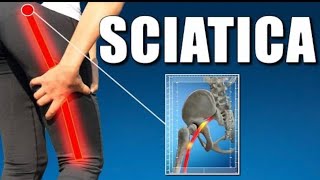 Sciatica pain relief exercise 🔥 Easy exercise for Sciatica at home😍yoga Blissyoga16 shots [upl. by Ynahpit]