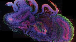 Brain organoids in simple terms [upl. by Soilissav410]