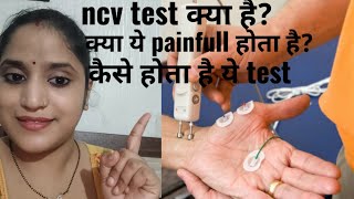 ncvtest ncv test painfull hota haiक्या एनसीवी टेस्ट मे दर्द होता हैwhat is ncv test [upl. by Anikram]