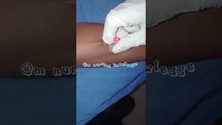 Intravenous cannulation procedure medico virlshort viral shotrs [upl. by Elisabet]