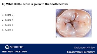 NEET MDS  INICET  Conservative Dentistry  Explanatory Video  MERITERS [upl. by Reinert]