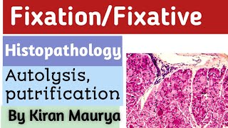 Fixationfixative histopathology Hindi and english by Kiran maurya  part 1 [upl. by Rehsu]