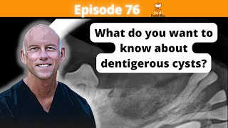 Ep 76  What do you want to know about dentigerous cysts [upl. by Hephzipa]