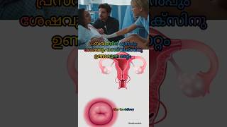 Changes of Cervics പ്രസവത്തിന് മുന്പും ശേഷവും സെർവിക്സ്🤰🏽baby pregnancy parenting shorts short [upl. by Eiramrefinnej]