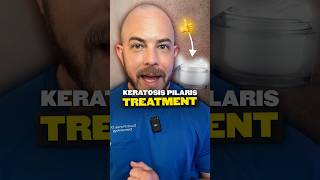 What is keratosis pilaris Derm explains keratosispilaris [upl. by Earesed214]