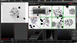 DCScore  Automated Scoring of Dicentric Chromosomes [upl. by Zared111]