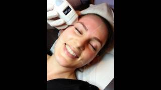 Emerge Fractional Laser [upl. by Rodmun]