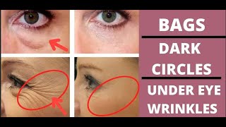 ANTIAGING FACE EXERCISES FOR EYE BAGS DARK CIRCLES PUFFY EYELIDS EYE WRINKLES [upl. by Wolfe]