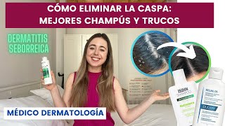 MÉDICO EXPLICA CÓMO ELIMINAR LA CASPA  MEJORES CHAMPÚS 2023  DERMATITIS SEBORREICA MUJER Y HOMBRE [upl. by Renato]