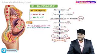 Rh Isoimmunization  Obstetrics and gynaecology lectures [upl. by Stetson164]