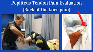 Popliteus Tendon Evaluation Back of the knee pain [upl. by Millham]