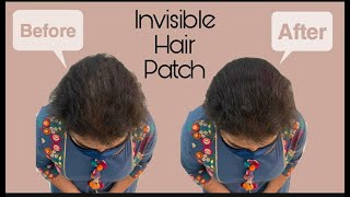 Invisible Hair Patch  Cover Up Your Hair Thinning  Hair Thinning Solution For Women  1HS [upl. by Eibrad]