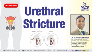 Urethral Stricture  Type Cause Symptoms Complication Diagnosis amp Treatment [upl. by Yddor]