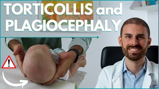 How to TREAT BABY TORTICOLLIS and PLAGIOCEPHALY  Dr Matteo Silva Pediatric Osteopath [upl. by Cart619]