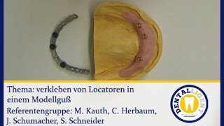 ZahntechnikKonventionellLocatorMatritzen in einem Modellguss verkleben [upl. by Sudnak]