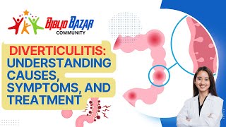 🌀 Deciphering Diverticulitis Causes Symptoms and Treatment Explained 🏥 [upl. by Nirrac]