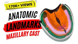 Lets Learn Anatomic landmarks in maxillary cast [upl. by Anatniuq]