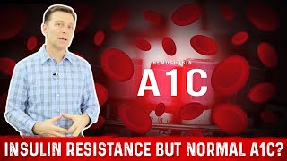 Normal A1C But Why Do I have Insulin Resistance – Dr Berg [upl. by Ianaj]