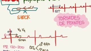 EKG 08 QT Interval and Torsades de Pointes [upl. by Wennerholn742]