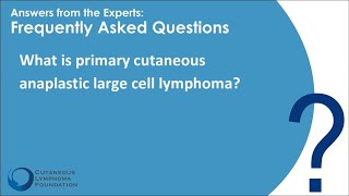 Rare Variant Primary Cutaneous Anaplastic Large Cell Lymphoma [upl. by Canon]