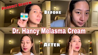 Dr Hancy Melasma Cream Product Review vlog vlog3 skincare skincarereview skincareproductreview [upl. by Acire82]