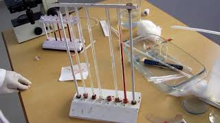 Erythrocyte sedimentation rate [upl. by Yerak]