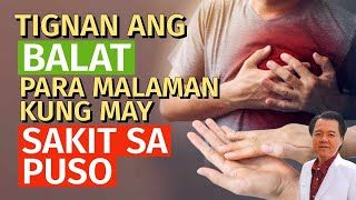 Tingnan ang Balat Para Malaman Kung May Sakit sa Puso  By Doc Willie Ong [upl. by Rocco]