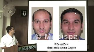 How to choose a Hair Transplant Surgeon FUT or FUE Cost Medispa By Dr Suneet Soni Jaipur Delhi [upl. by Anastas]