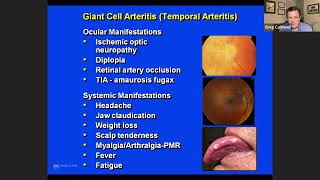 Old Diseases New Drugs A NeuroOphthalmologist’s Perspective [upl. by Dnalrah]