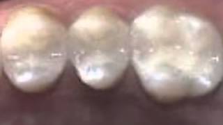 معمل العبير التخصصي لتركيبات الاسنان  alabeer dental lab [upl. by Bryant]