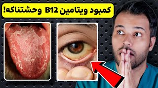 شوکه کننده کمبود ویتامین B12 چه تاثیر وحشتناکی روی بدن میذاره؟ [upl. by Puri724]