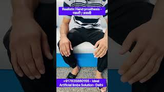 9560841343 Best prosthesis  artificial arm Hand  hand prosthesis silicon finger prosthetics [upl. by Annoeik]